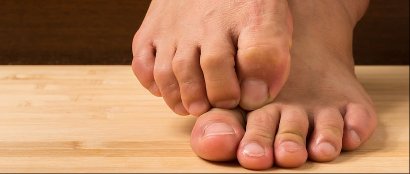 La terapia con láser ha demostrado gran efectividad para curar el hongo en las uñas en decenas de miles de personas. (Shutterstock)
