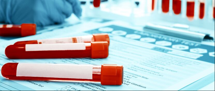 Es importante que las personas se hagan las pruebas para detectar el virus de hepatitis C, especialmente si tiene entre 50 a 75 años y si recibió una trasfusión de sangre antes de 1992. (Shutterstock)